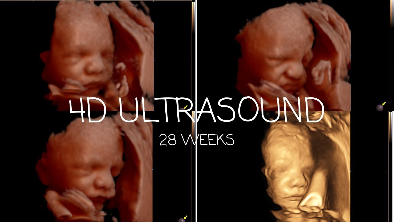 3d Ultrasound At 28 Weeks