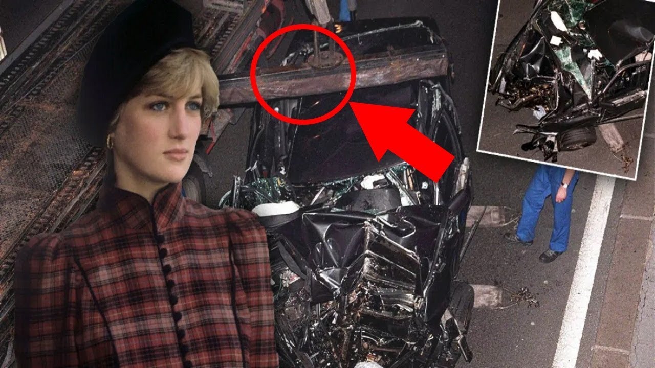 Princess Diana Car Crash Injuries image.