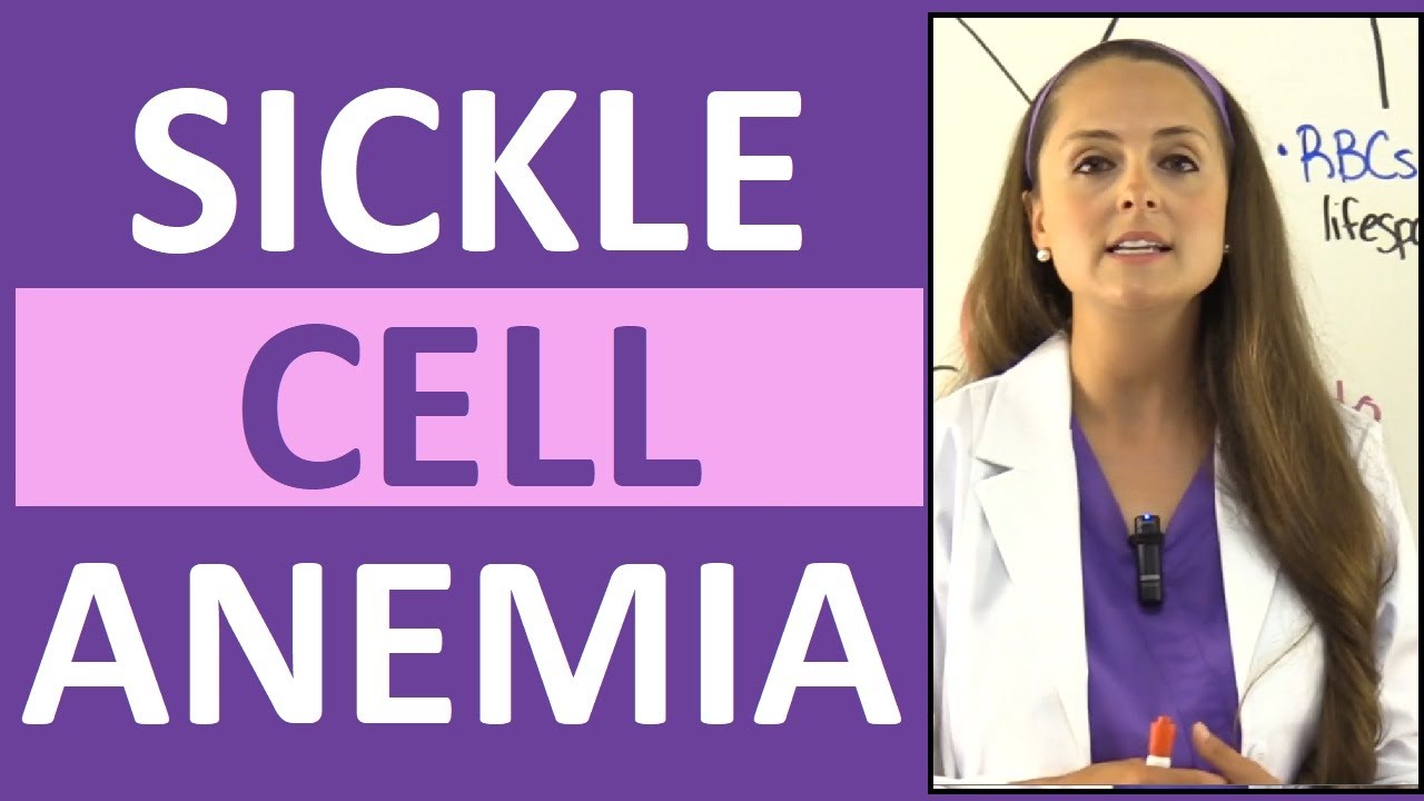 Complete Care Plan For Sickle Cell Anemia (Nursing Care, 59% OFF