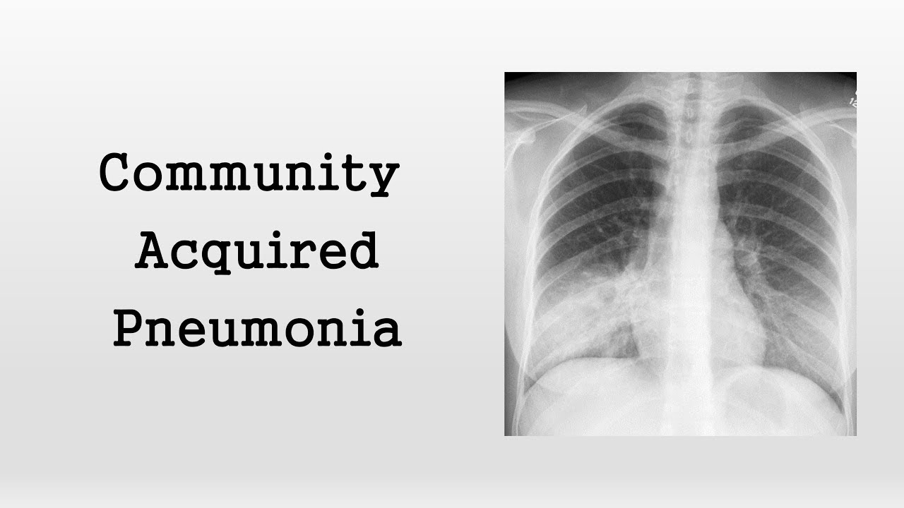 Pneumonia Types