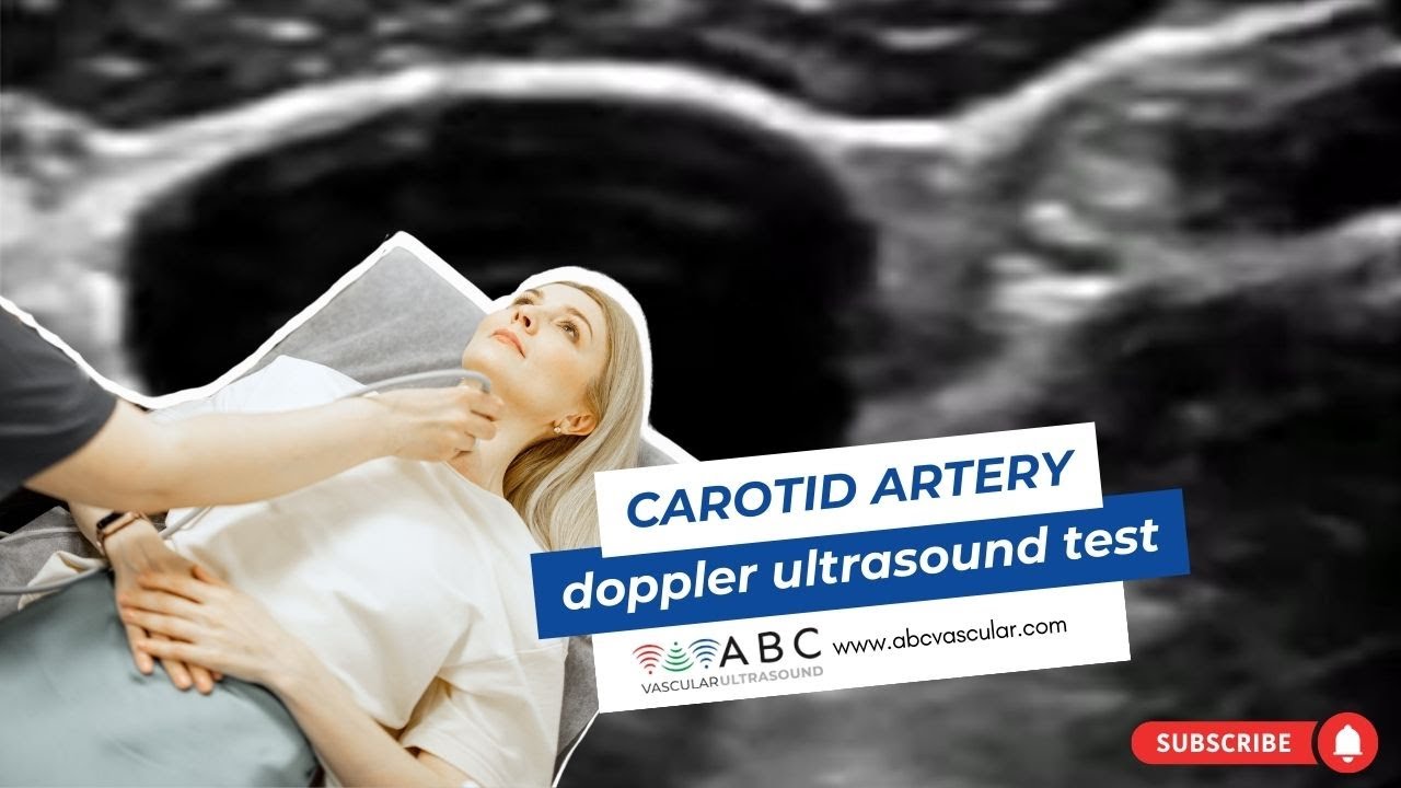 Carotid Artery Doppler Ultrasound Test How To Perform A Basic | Hot Sex ...