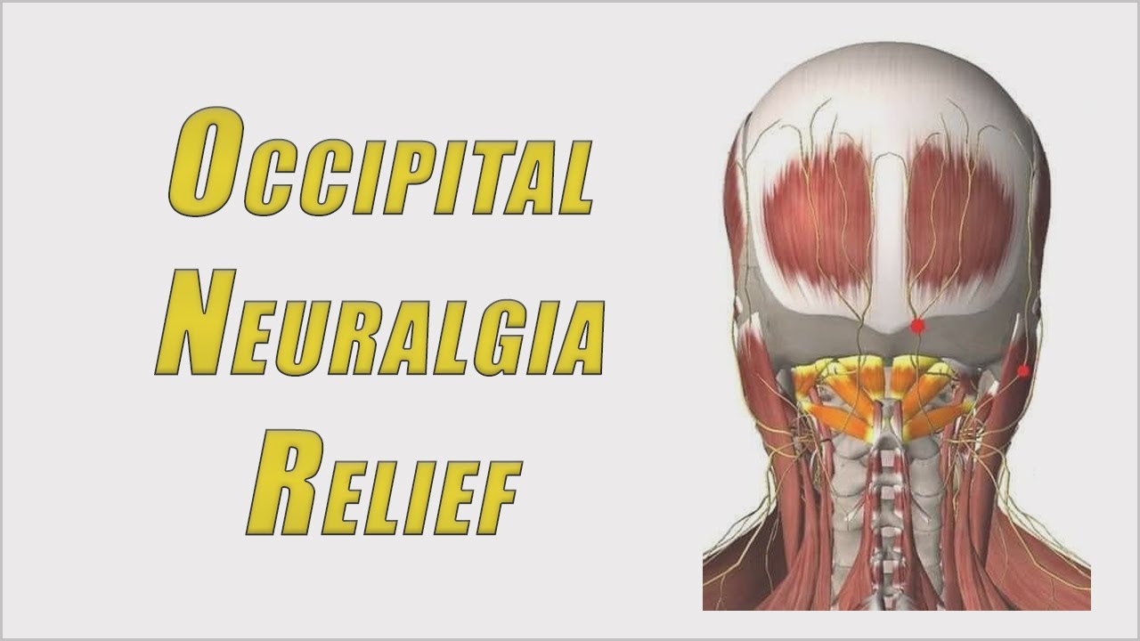 Occipital Neuralgia Cures