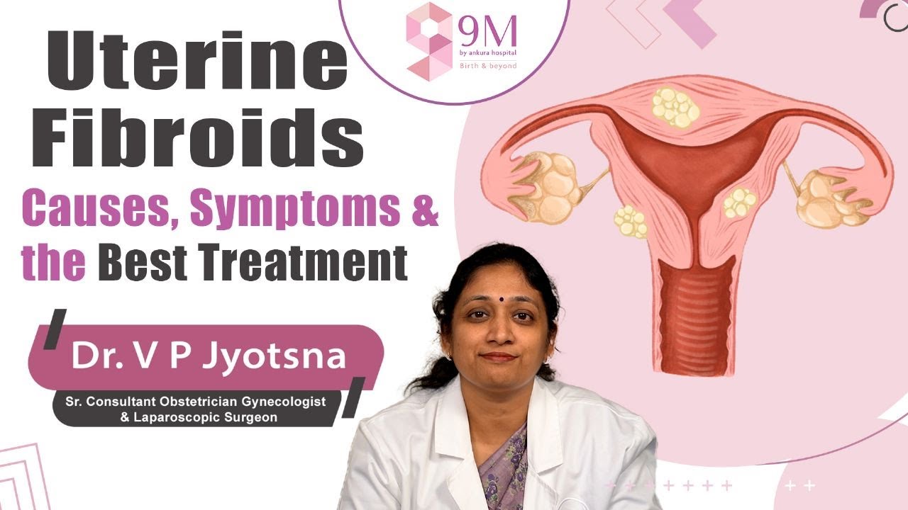 Signs and Symptoms of Fibroids in Uterus || Dr. VP Jyotsna || 9M ...