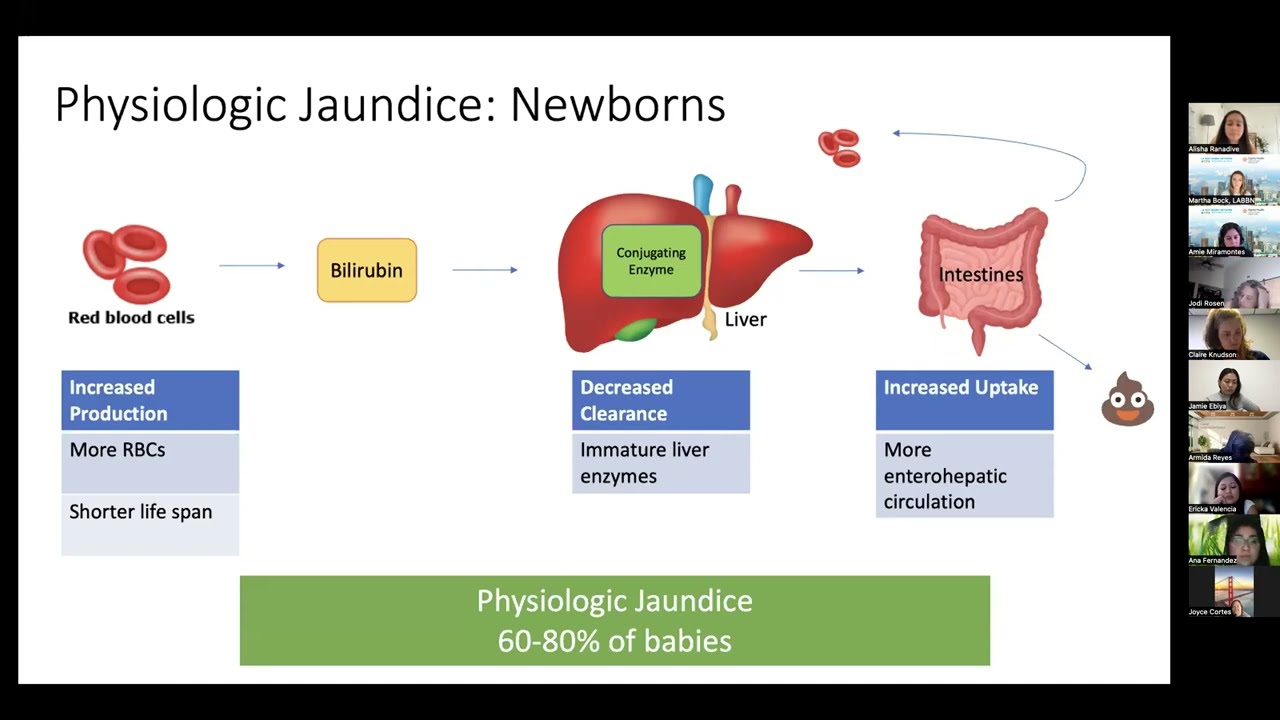 Neonatal Jaundice Pathophysiology