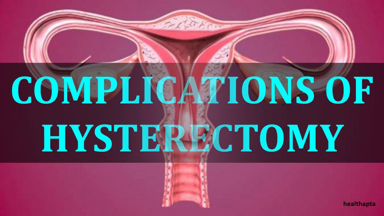 Hysterectomy Meaning