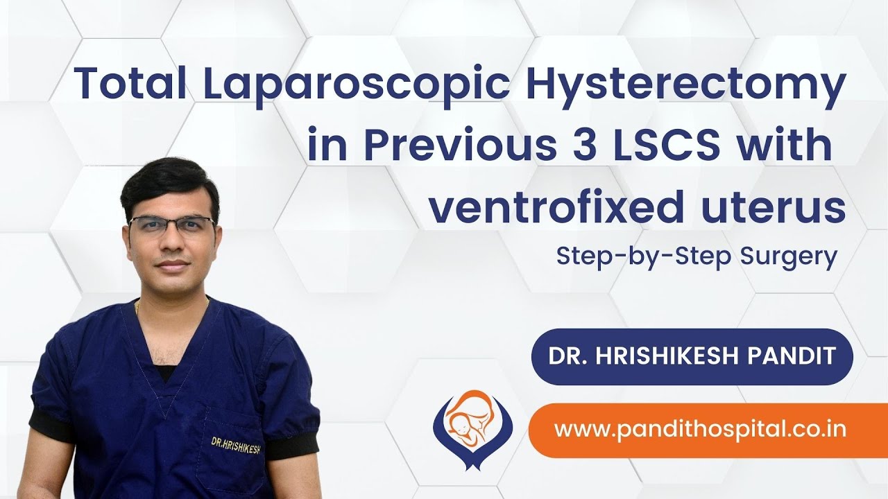 Total Laparoscopic Hysterectomy in Previous 3 LSCS with ventrofixed ...