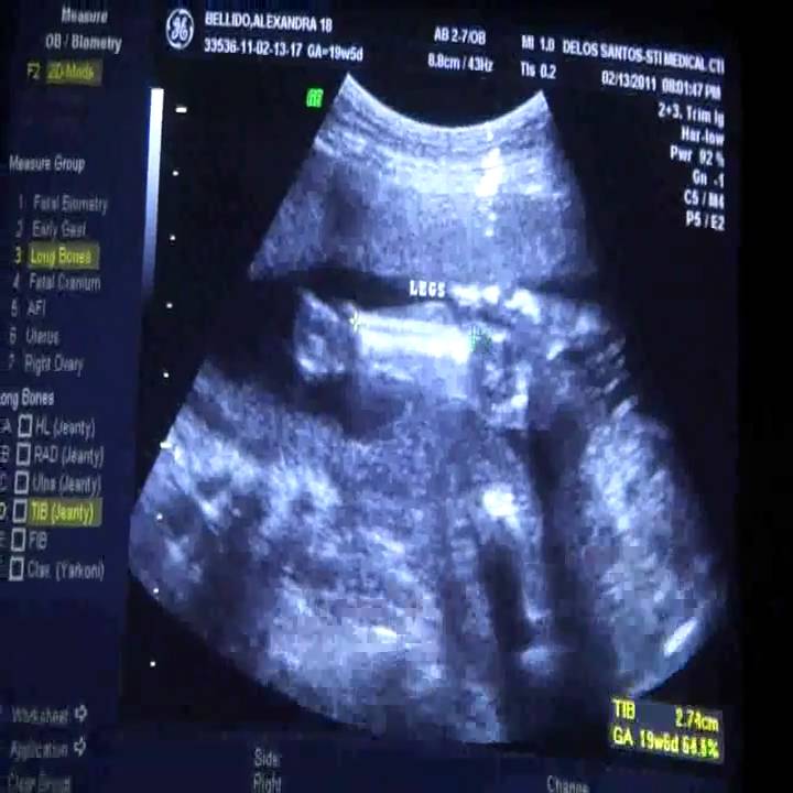 It's a Baby Boy!!! - YouTube