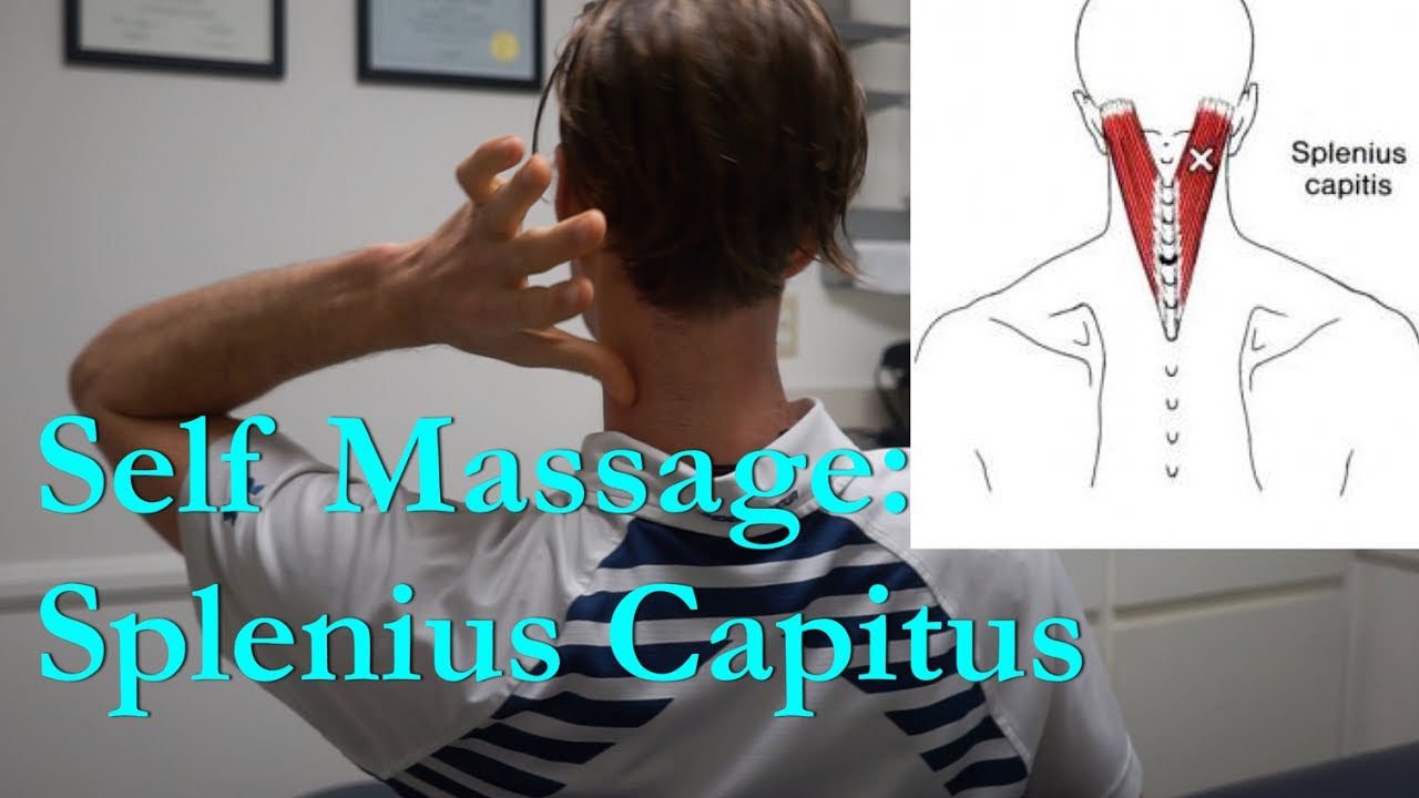 Longus Capitis Trigger Points