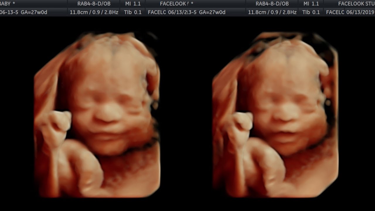 OUR BABY'S 4D ULTRASOUND | 27 WEEKS PREGNANT - YouTube