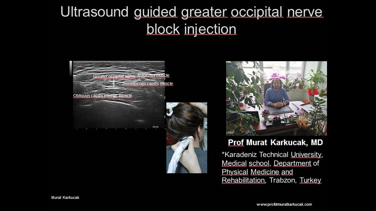 Occipital Nerve Block