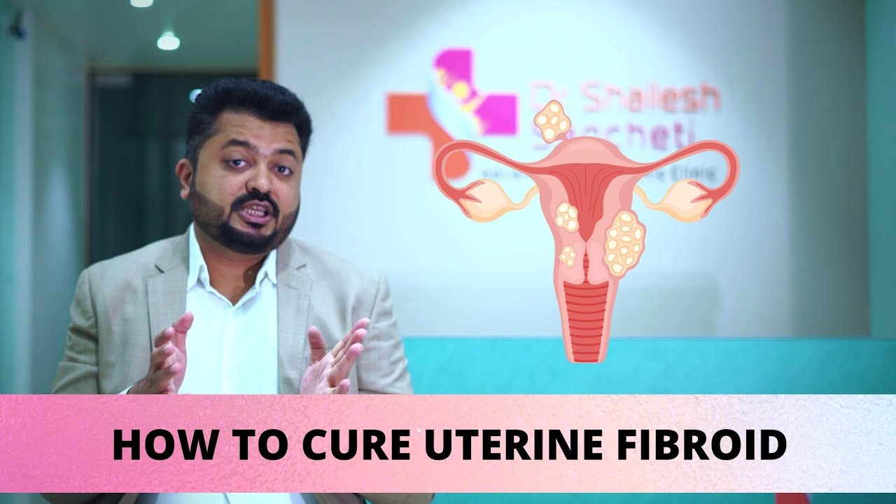 Uterine Fibroid Treatment by Homeopathy | Best Homeopathic Treatment ...