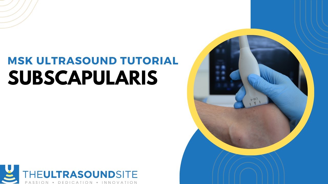 Subscapularis Ultrasound