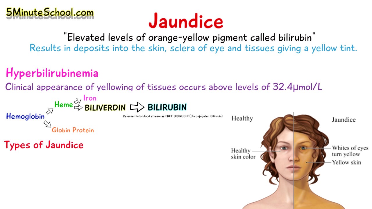 WHAT IS JAUNDICE? - SIMPLE EXPLANATION OF 3 MAIN CAUSES - YouTube