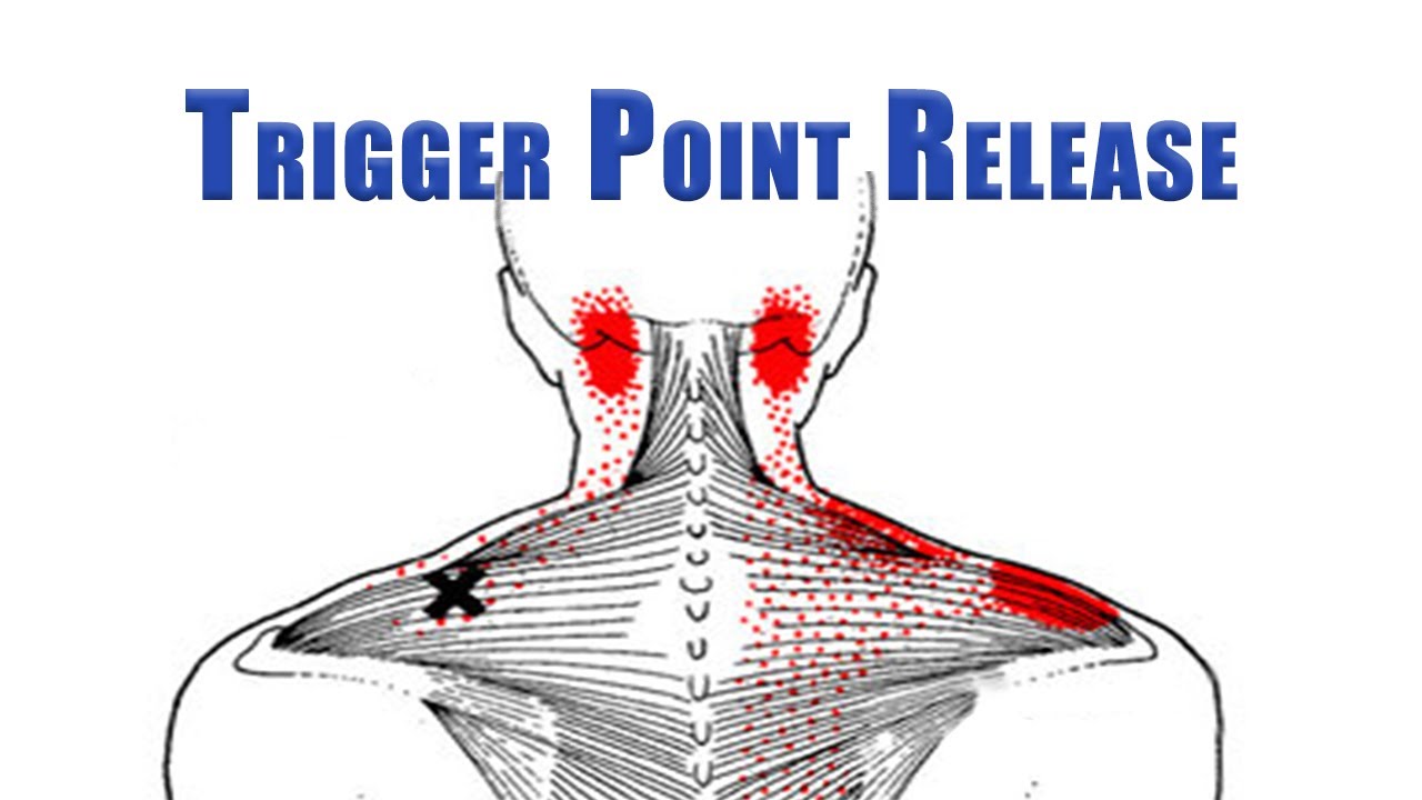 Price-Wise Wonder Trapezius muscle pain & trigger points, trapezius ...