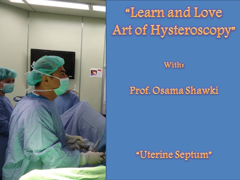 Magic Of Hysteroscopy By Osama Shawki Innovative Vaginal Septum | My ...