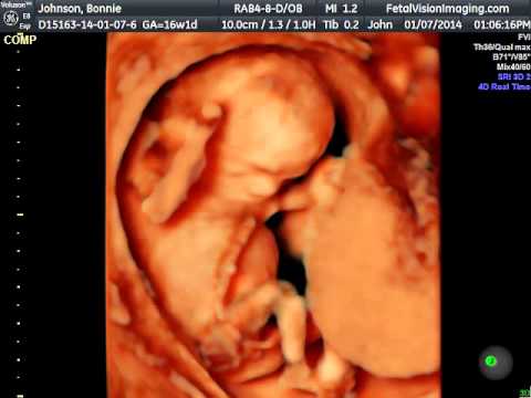 FetalVisionImaging.com 16 weeks HD 4D Ultrasound - YouTube