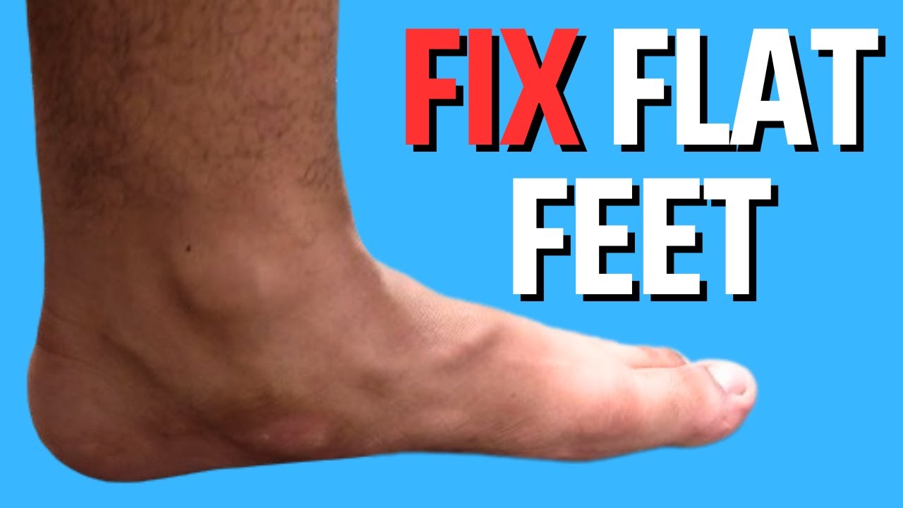 How To Fix Flat Feet & Fallen Arches - YouTube