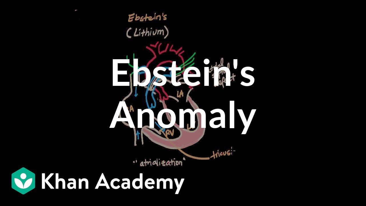 Ebstein's anomaly | Circulatory System and Disease | NCLEX-RN | Khan ...