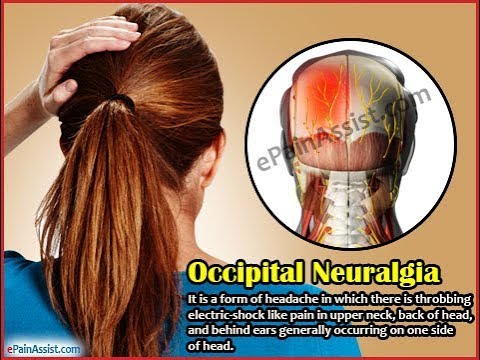 Greater Occipital Nerve Pain