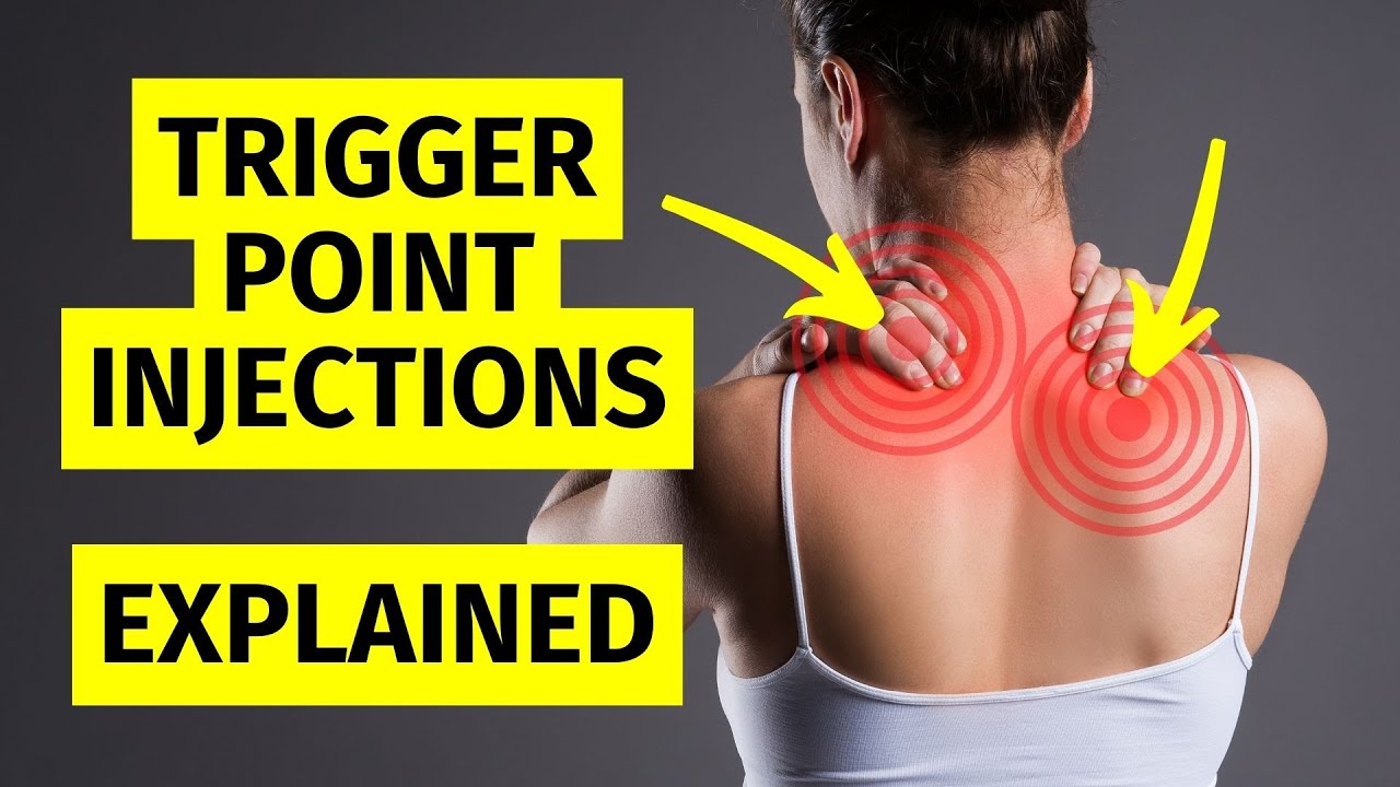 Rotator Cuff Tear Trigger Point Of The Week