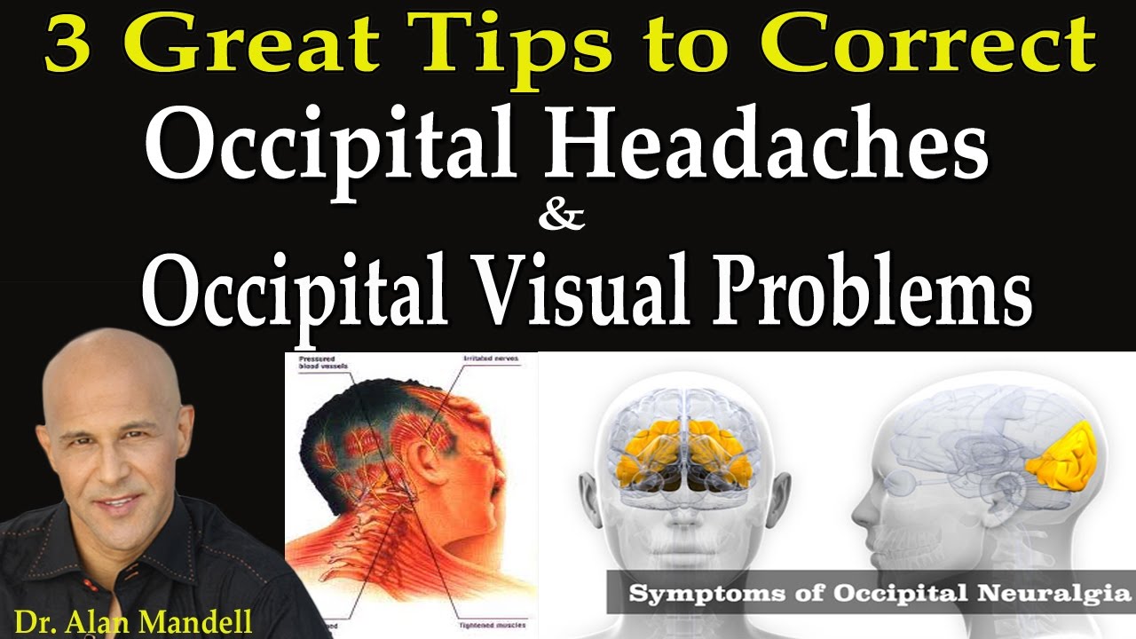 Occipital Neuralgia Cures