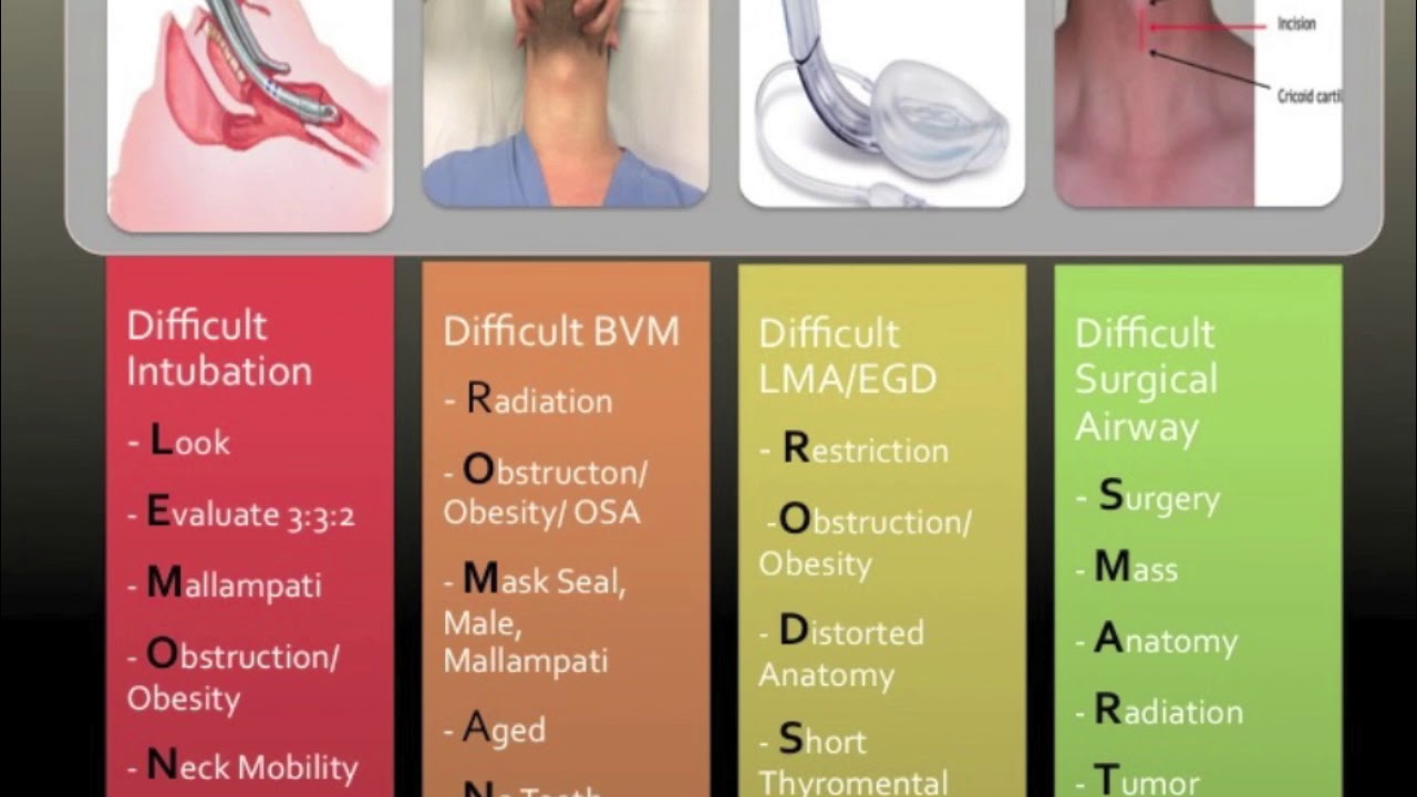 Intubation Airway View