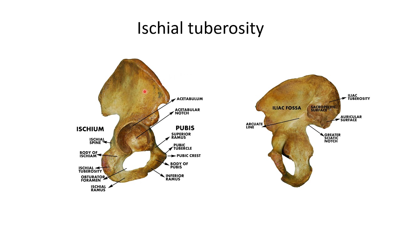 ISCHIAL TUBEROSITY - YouTube