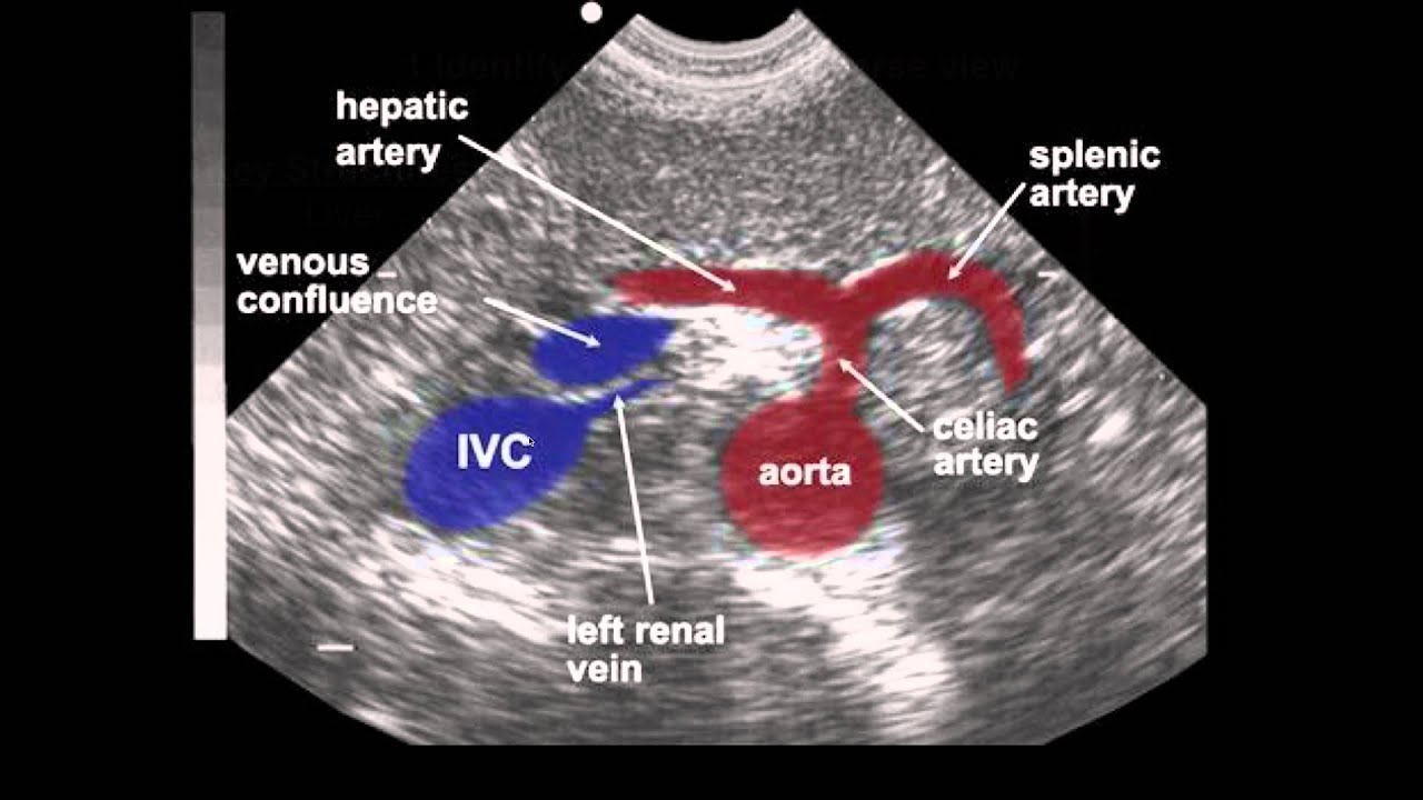 Aorta Anatomy Ultrasound