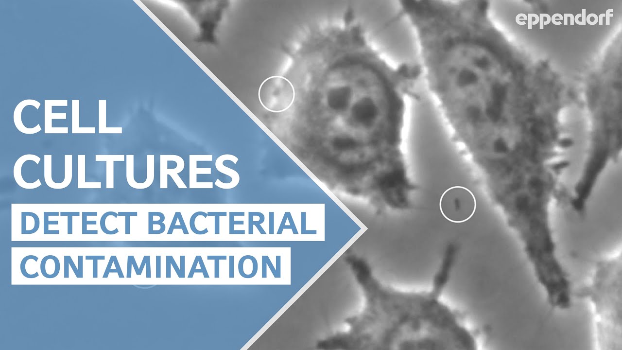 Moving Bacteria in Cell Culture - YouTube