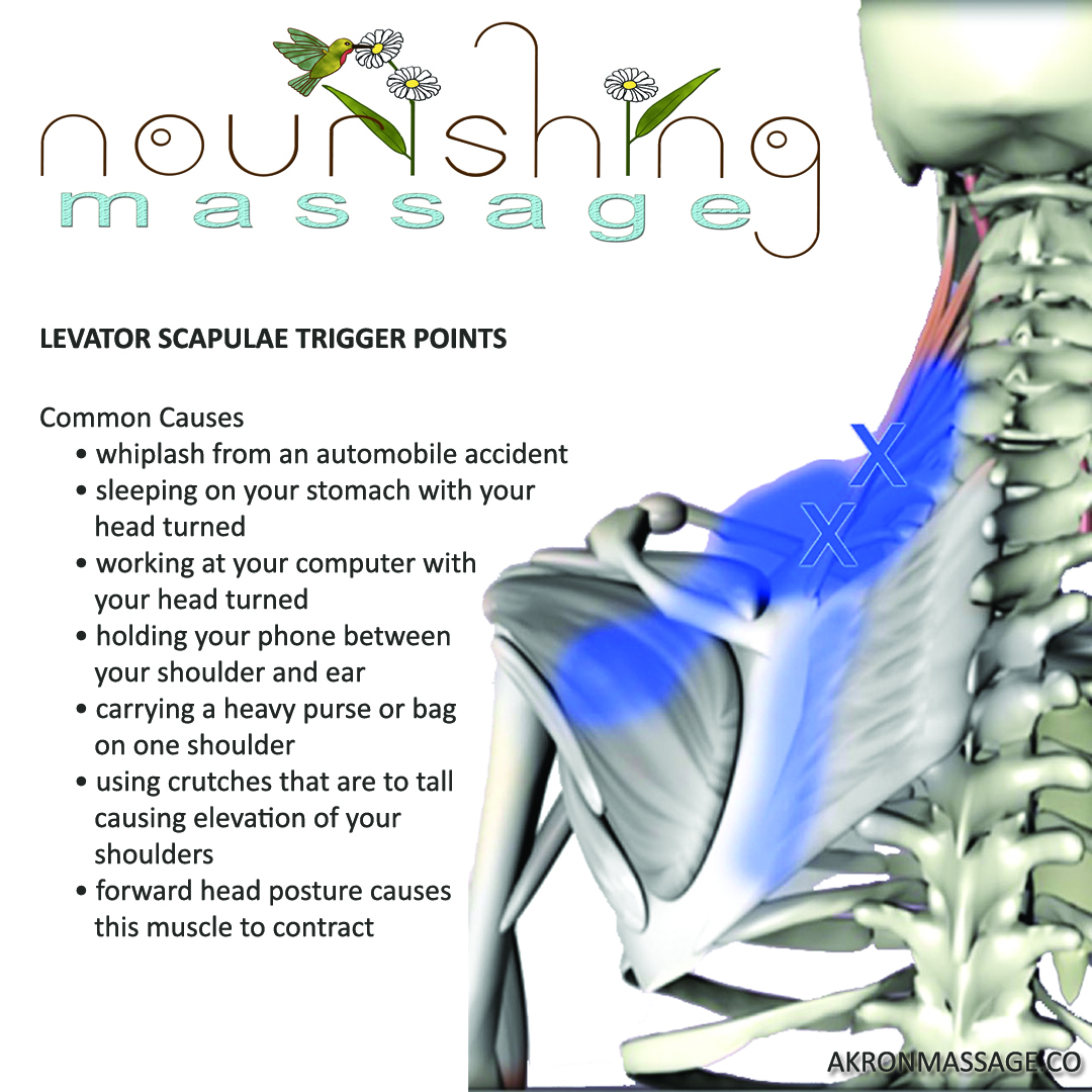 Levator Scapulae Trigger Points