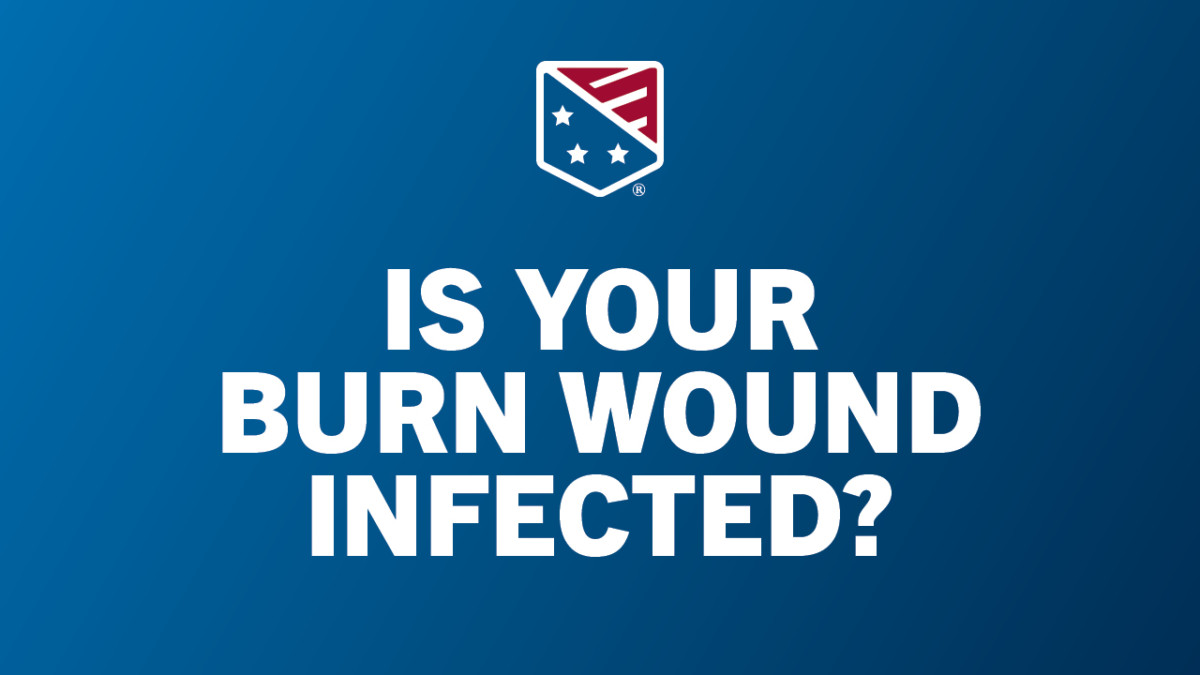 What an infected burn looks like, and how to tell if your burn is ...