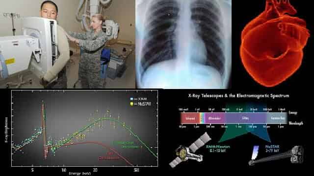 Read more about the article X-Ray Radiology Complete