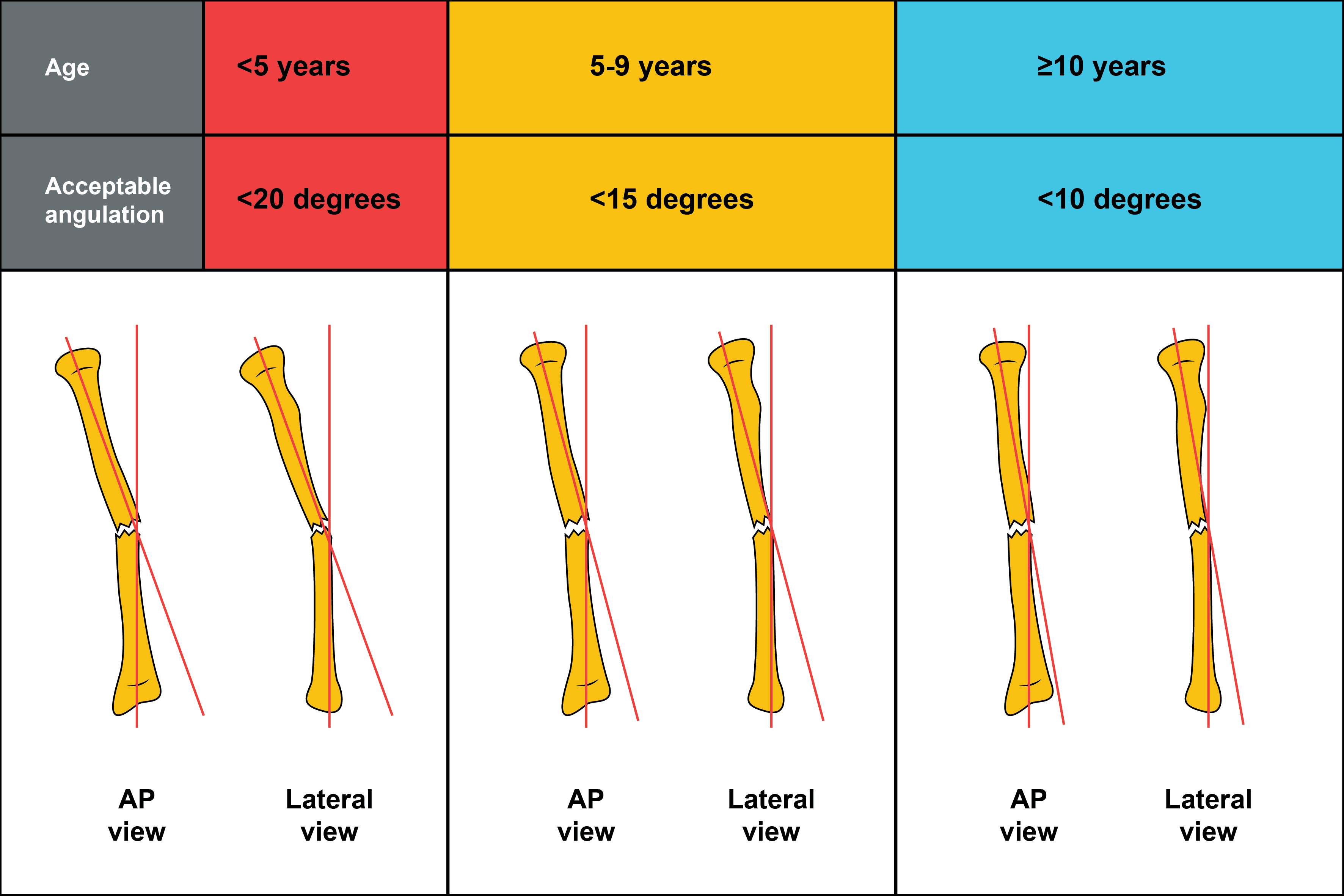 Distal Ulna Fractures ScienceDirect, 41% OFF