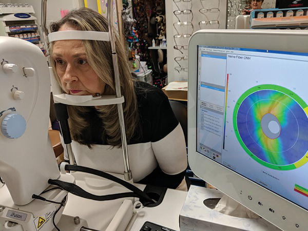 Photo depicts optical coherent tomography performed in office showing normally thicker nerve fiber layer inferiorly and superiorly.