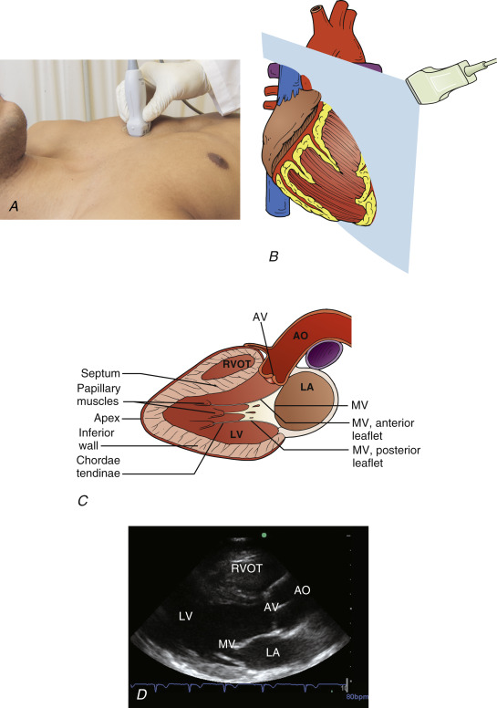 Cardiac Ultrasound Technique | Radiology Key