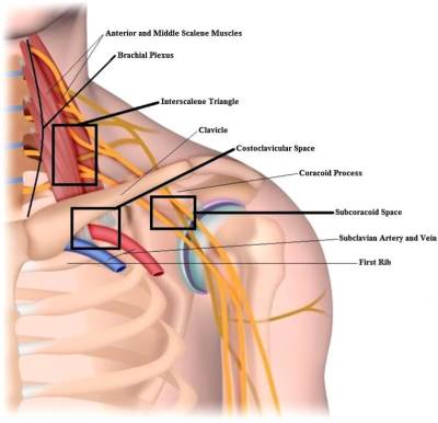 Exercises For Thoracic Outlet Syndrome – [𝗣]𝗥𝗲𝗵𝗮𝗯