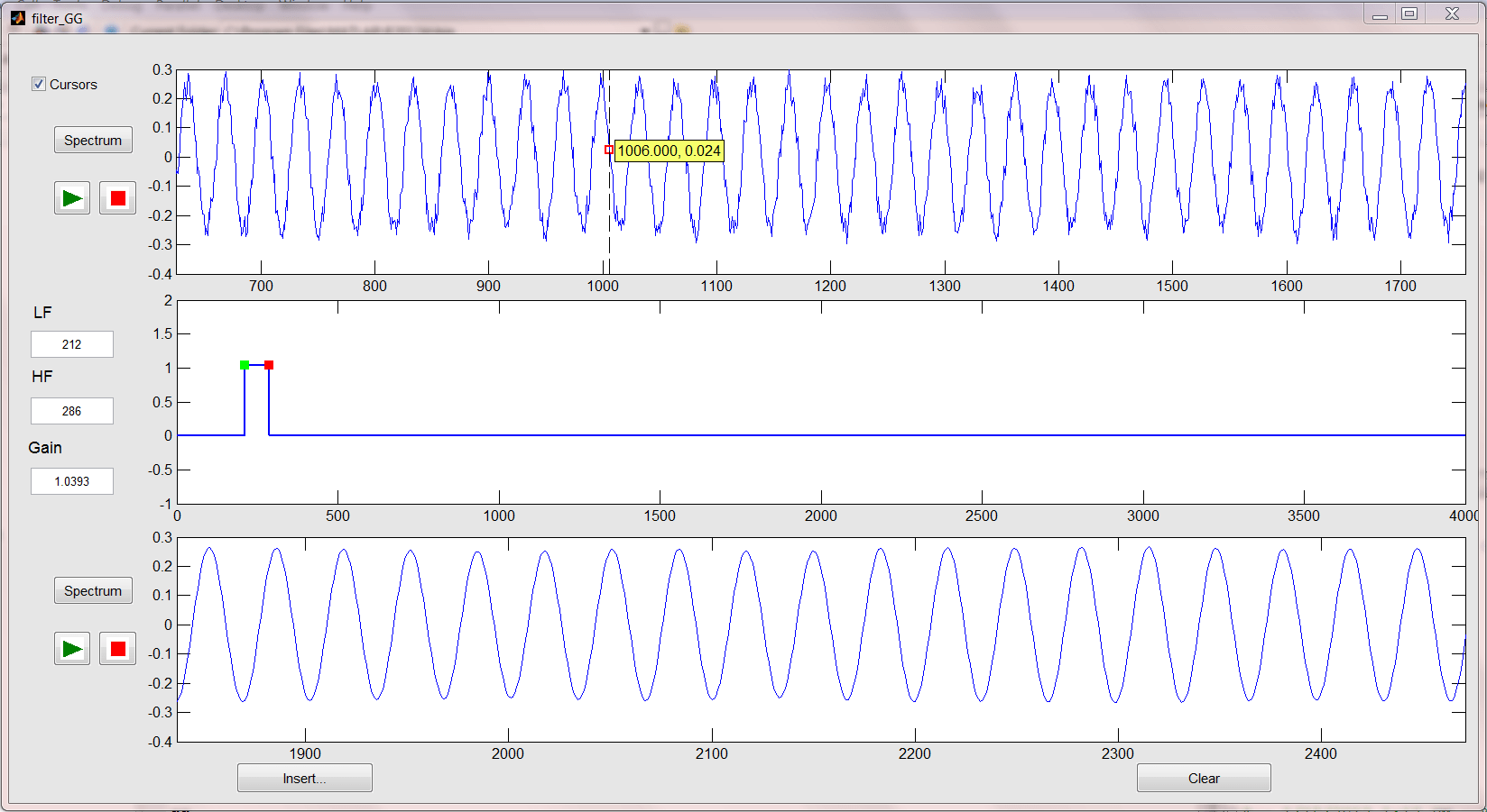 ☑ High Pass Filter Matlab