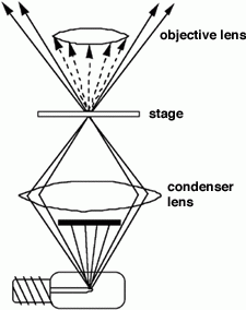 darkfield microscopy