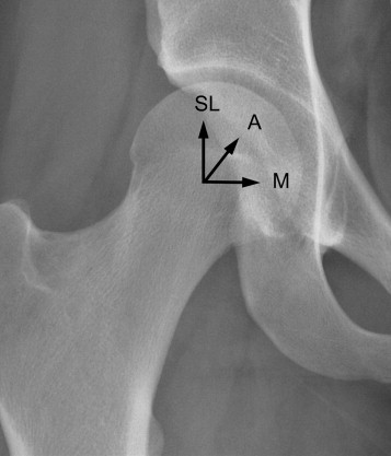 Approach to the Hip | Musculoskeletal Key