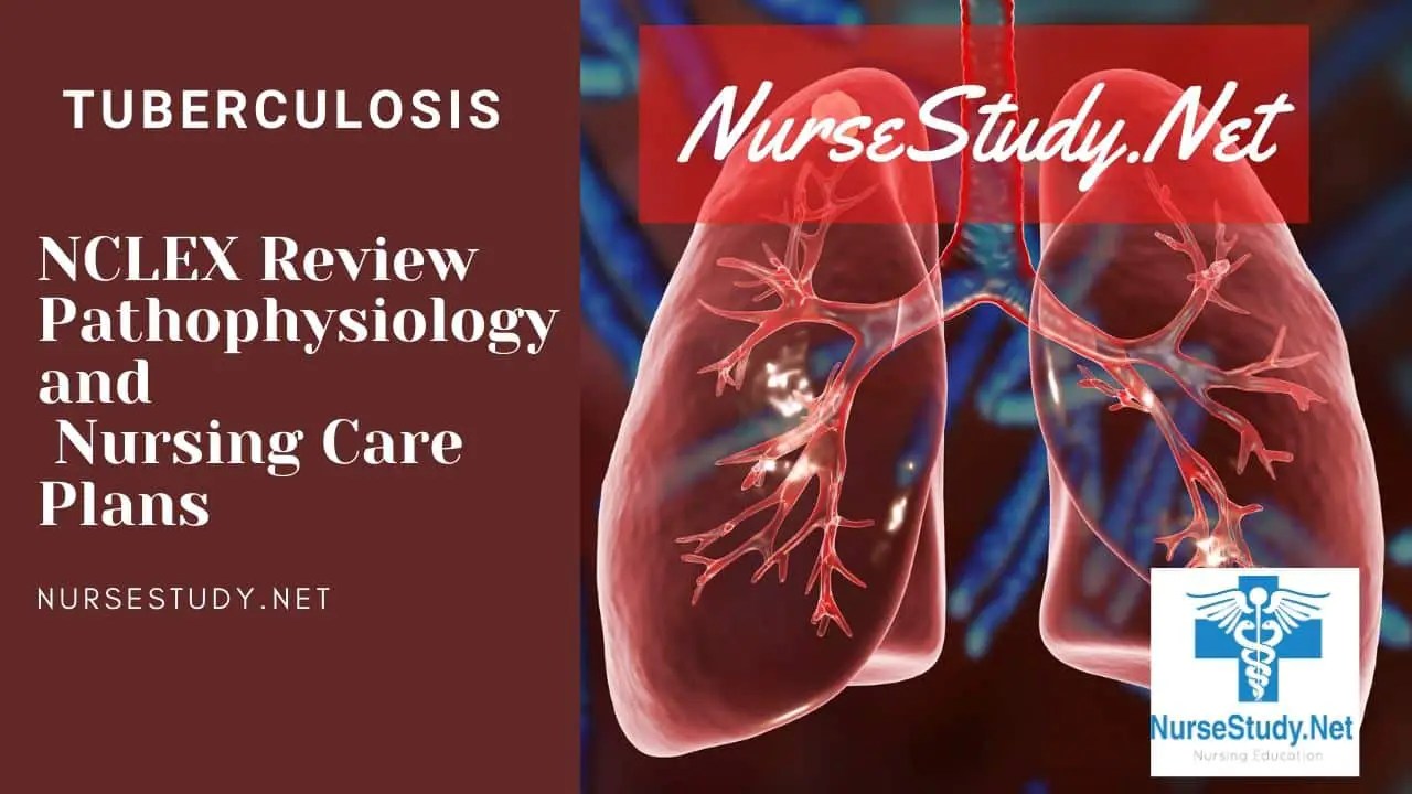 Tuberculosis Nursing Diagnosis Care Plan - NurseStudy.Net