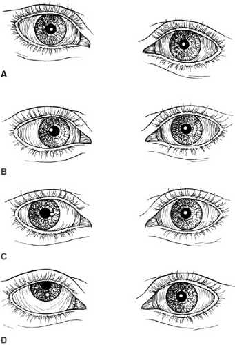 Ophthalmology | Obgyn Key