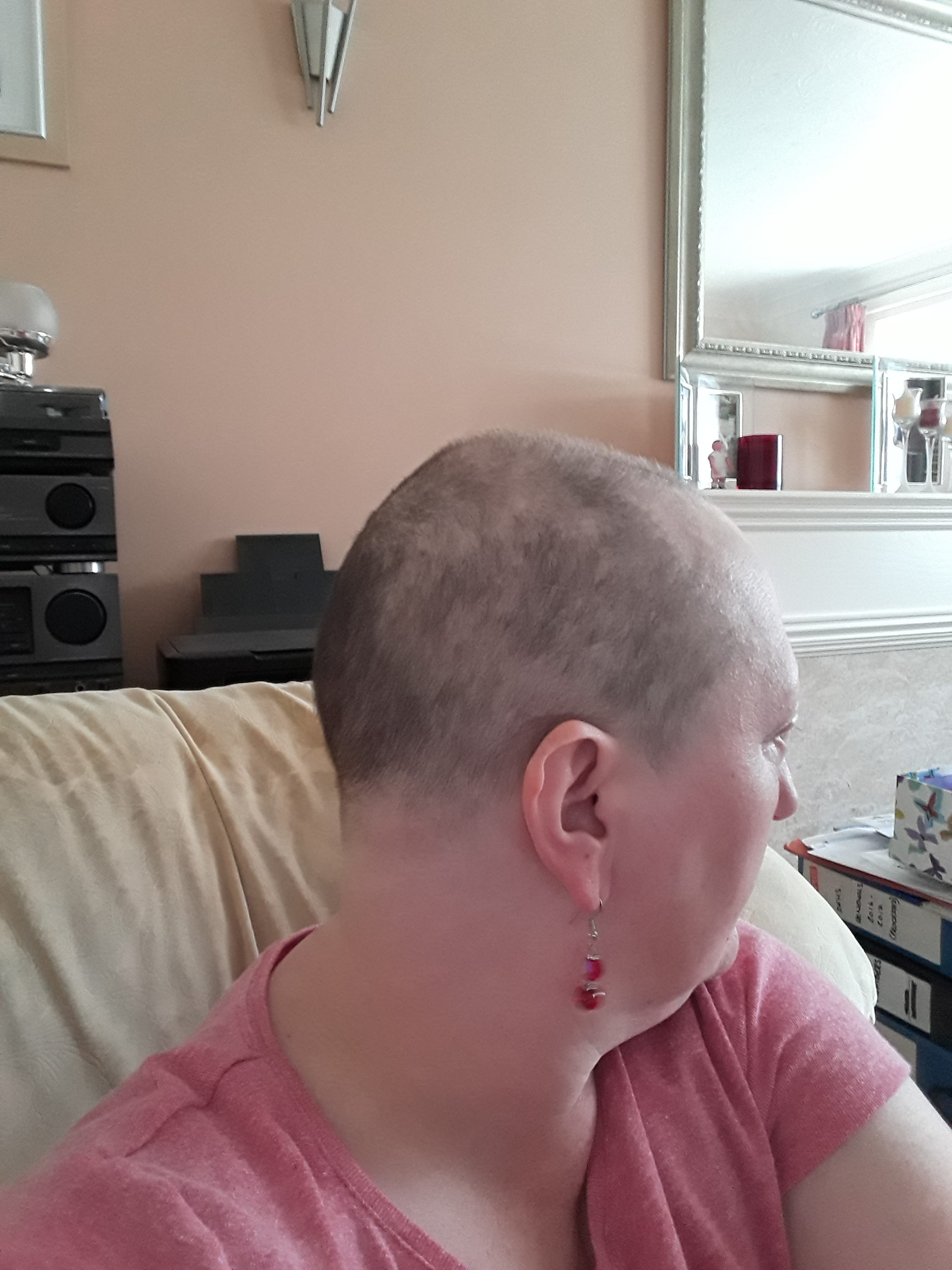 shortdarkhair Hair Growth After Chemo Pictures