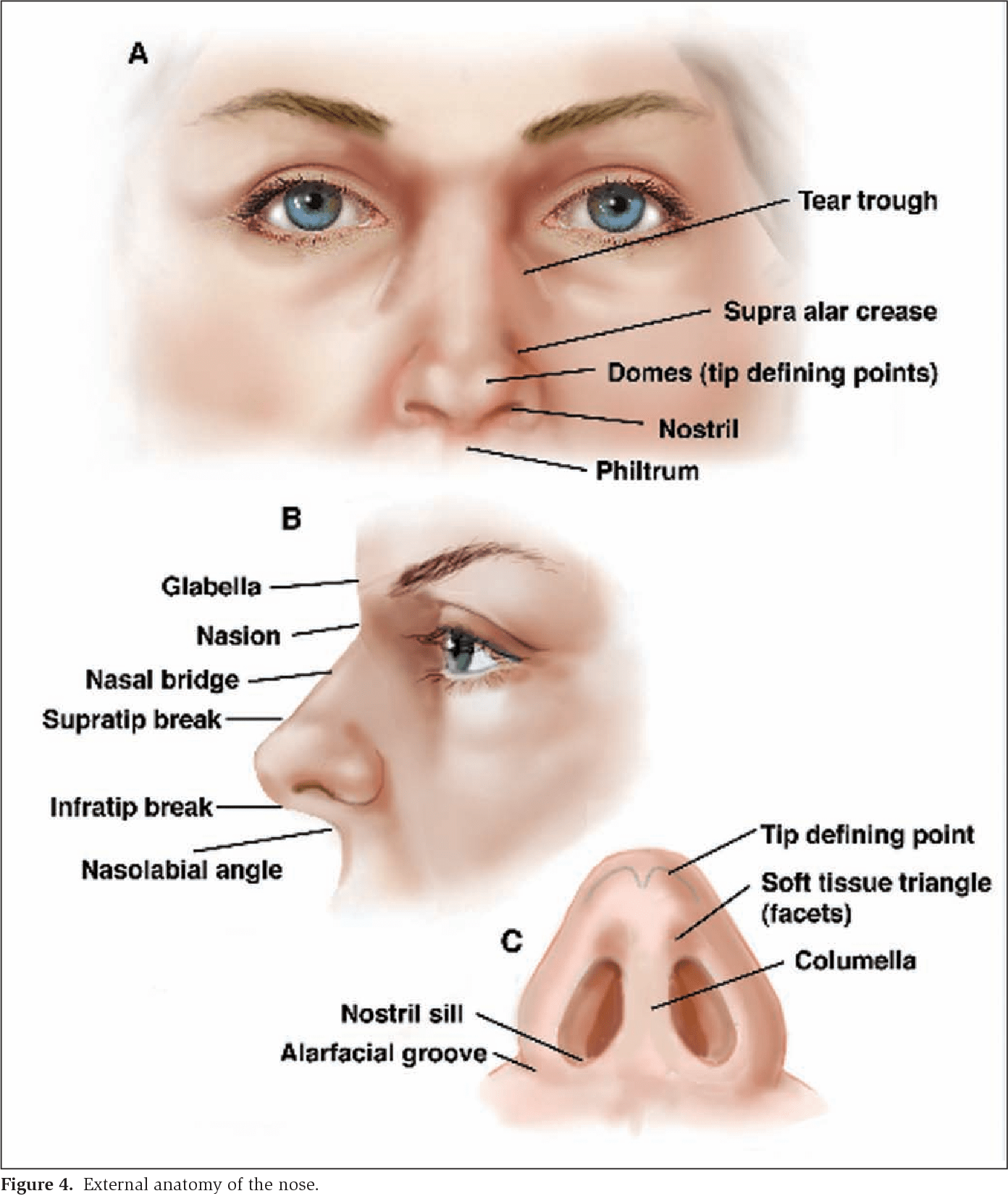 Figure 4 from Surgical treatment of nasal obstruction in rhinoplasty