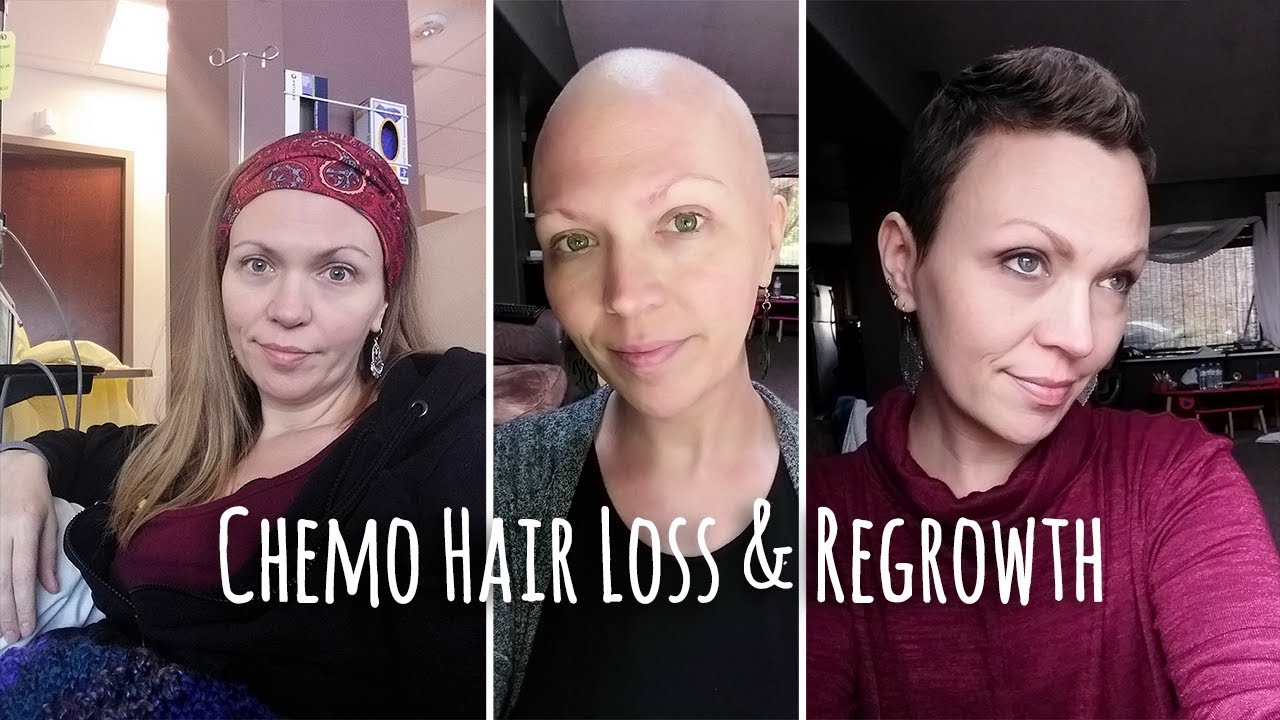 Chemo Hair Loss and Regrowth Timeline YouTube