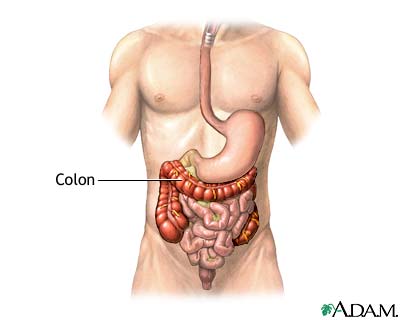 Colon diverticula - series—Normal anatomy: MedlinePlus Medical Encyclopedia