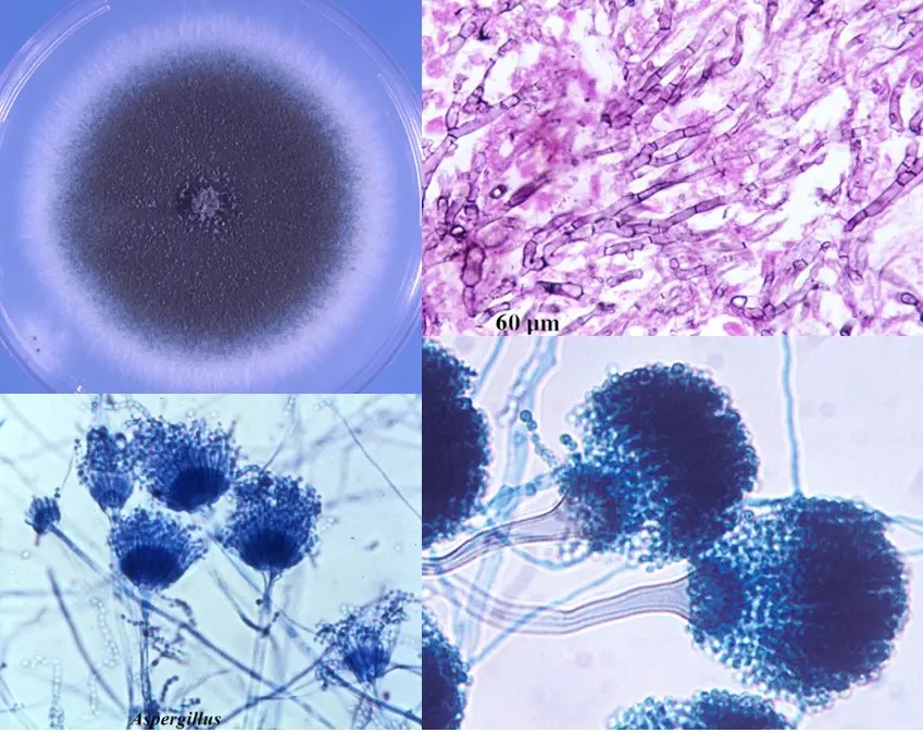 Aspergillus Fumigatus Under Microscope