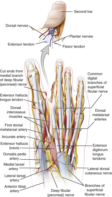 Toe Flaps and Toe Transplantation | Plastic Surgery Key