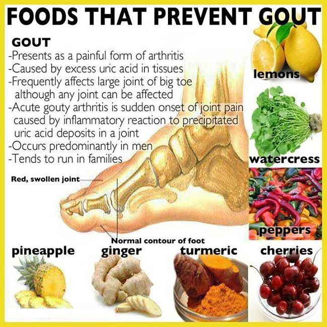 Lower Uric Acid, Prevent Gout Naturally Using a Low Purine Diet