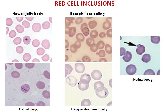 Peripheral smear RBC Histopathology.guru