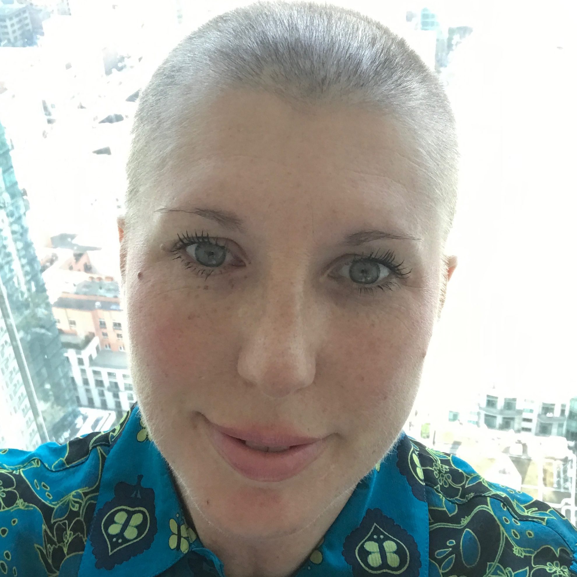 Hair Loss and Regrowth After Chemotherapy The Patient Story